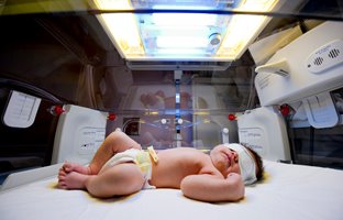 زردی نوزاد چیست و چگونه درمان می‌شود؟ نشانه ها و علل بروز
